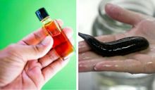 Risiko memakai minyak lintah (foto/ilustrasi) 