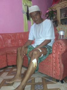 Warga Desa Sikakak Cerenti mengalami luka robek akibat diterkam buaya/zar