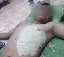 Kondisi Thoriq usai dianiaya 