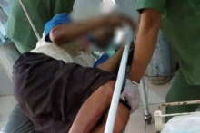 Korban Slamet yang sempat dirawat akibat mengalami kecelakaan ketika membantu memadamkan Karhutla. Foto: int 