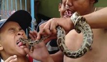 Lidah Bocah Berdarah Digigit Ular Sanca