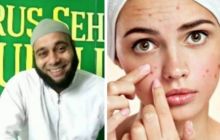 Dokter Zaidul Akbar berikan tips agar terbebas dari masalah jerawat menahun (foto/int)