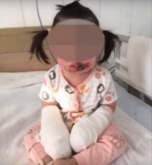 Mengerikan, Dibiarkan Sang Ibu Bermain di Kamar, Bayi Berusia Dua Tahun Ini Alami Kejadian yang Mengenaskan