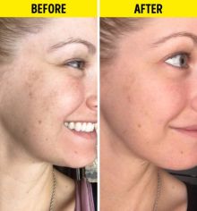 Enam Alasan Mengapa Serum Vitamin C Sangat Baik Untuk Kulit Anda