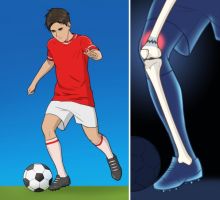 Inilah Tujuh Alasan Mengapa Salah Satu Kaki Anda Bisa Menjadi Lebih Pendek