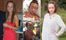 Wanita Ini Mengalami Reaksi Mengerikan Terhadap Obat Penghilang Rasa Sakit, Ini Peringatan Dokter Bagi Pasien yang Suka Menggunakan Ibuprofen 