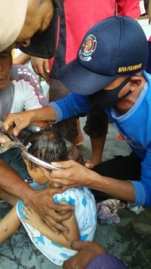 Proses pelepasan tutup panci dari kepala seorang bocah