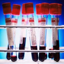 Peneliti Ungkap Kekebalan Tubuh Terhadap COVID-19 Tidak Permanen, Ini Alasannya...