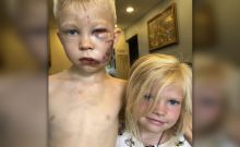 Jadi Viral, Aksi Bocah Berusia 6 Tahun yang Berusaha Menyelamatkan Saudarinya Dari Serangan Anjing di Wyoming 