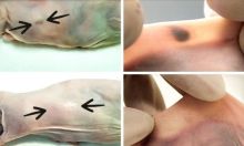 Di Swiss, Ilmuwan Menyarankan Cara Sederhana Ini Untuk Mendiagnosis Tanda Dini Penyakit Berbahaya