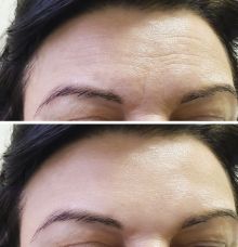 5 Gerakan Sederhana di Siang Hari Untuk Menurunkan Berat Badan dan Terlihat Lebih Muda