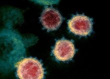 Seperti Ini Bentuk Mematikan Virus Corona Jika Dilihat Dari Bawah Mikroskop