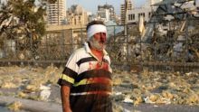 Salah seorang warga yang terluka setelah ledakan besar menghantam Ibukota Lebanon, Beirut, Selasa waktu setempat. Foto:  int 