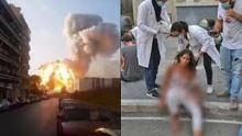 Seorang perempuan korban ledakan di Beirut mendapat perawatan dari tim medis. Di sampingnya rekaman tentang dahsyatnya ledakan yang mengguncang Beirut. Foto: int 