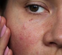 Wajib Dicoba, Inilah 5 Keajaiban Untuk Kulit  Saat Anda Mandi Dengan Air Dingin, Bisa Bikin Kulit Glowing Lho...