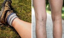 4 Masalah Kesehatan Yang Mungkin Ditunjukkan Oleh Kaus Kaki Anda