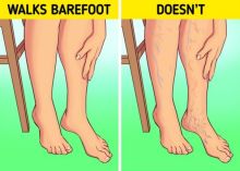 Inilah Reaksi Tubuh Saat Anda Lebih Sering Berjalan Dengan Telanjang Kaki 