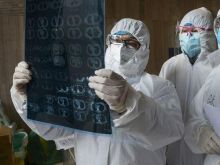 Hasil Otopsi Pasien COVID-19 Mengungkap Fakta Mengejutkan, Menunjukkan Paru-Paru Seperti Bola Kulit