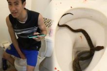 Berhati-Hatilah Saat Akan Menggunakan Toilet Duduk, Jangan Sampai Mengalami Seperti Kisah Mengerikan Seperti Lelaki Asal Thailand Ini