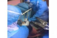 Kasihan, Kepala Bocah Pasien Covid-19 Ini Tersangkut di Ranjang Sebuah Rumah Sakit