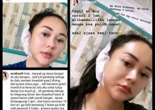 Aura Kasih Dilarang 2 Bulan Enggak Boleh Naik Pesawat dan Berenang Karena Ini (foto/int) 