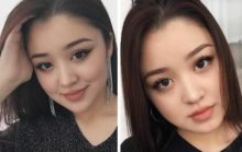 Pernah Divonis Lumpuh Seumur Hidup, Dayana Buktikan Kini Bisa Berjalan Lagi Setelah Berjuang Lawan Tumor (foto/int) 