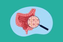 Ilustrasi radang usus (foto: Halodoc)