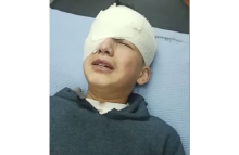 Izz el-Din Nedal al-Batsh saat mendapatkan perawatan usai diterjang peluru tentara Israel. Foto: WAFA