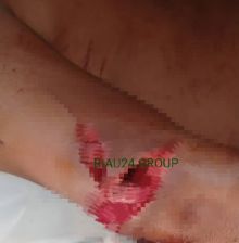 Korban pembacokan oleh Tiga ABK kapal jaring