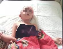 Bupati Inhil Akan Tanggung Biaya Pengobatan Bocah Perempuan Asal Tokolan (foto/rgo)