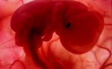 Foto : World of Buzz