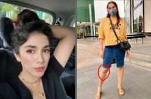 Lutut Ussy Sulistiawaty Luka Jatuh Dari Sepeda, Netizen: Korengan Juga Tetap Kece (foto/int)