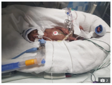 Mendiang Mohammed Rahaan