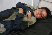 Seorang anak laki-laki Afghanistan yang terluka menerima perawatan di sebuah rumah sakit menyusul dugaan serangan udara Pakistan pada 16 April 2022 [AFP]