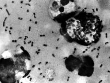 Ilustrasi wabah bubonic. Sumber: Detik.com