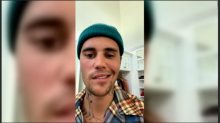 Justin Bieber alami Ramsay Hunt Syndrome/net