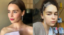 Emilia Clarke, pemain Game of Thrones yang pernah mengalami Aneurisma otak /Twitter
