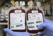 Ilustrasi kantong darah. Sumber: Internet