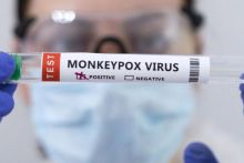 Akankah meningkatnya kasus Monkeypox menyebabkan HIV? Inilah yang dikatakan ilmuwan top ICMR