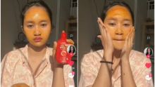 Potret Seleb TikTok yang Viral karena Pakai Betadine di Wajah (Suara.com)