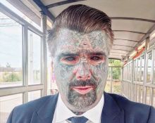  Pria di Inggris Ini Memiliki Bertato 90% di Tubuhnya Hingga Memiliki Pengalaman Buruk Berkat Penampilannya