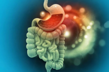 Ahli menyebutkan bahwa kembung dan sembelit tidak hanya masalah pencernaan namun bisa jadi usus bocor /net