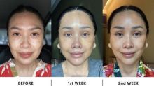Potret Before-After Titi DJ usai Lakukan Operasi Plastik untuk Anti Aging di Korea Selatan. (Lipiutan6.com/Foto)
