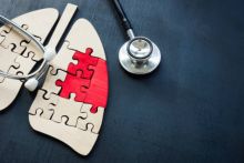 Ilustrasu Kanker Paru-paru. (Pixabay/Foto)