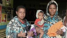 Potret Warga yang Anaknya Terkena Wabah Campak. (TribunPapua.com/Foto)