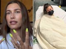 Kondisi Terkini Hailey Bieber yang menderita Stroke di Usia 25 Tahun, Ternyata Ini Alasannya. (9Honey/Foto)