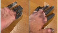 Mengenal Frostbite, Viral di TikTok Jari Menghitam-Membeku Bak Lilin