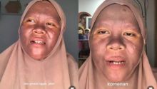 Buntut Krim Pemutih, Ini Sederet Fakta Wanita Kaltim yang Wajahnya Gosong