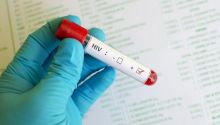 Pria Swiss Jadi Orang Ke-6 Dinyatakan 'Sembuh' HIV, Sempat Jalani Pengobatan Ini