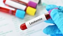 6 Gejala Leukemia Stadium Awal, Kerap Tak Disadari  